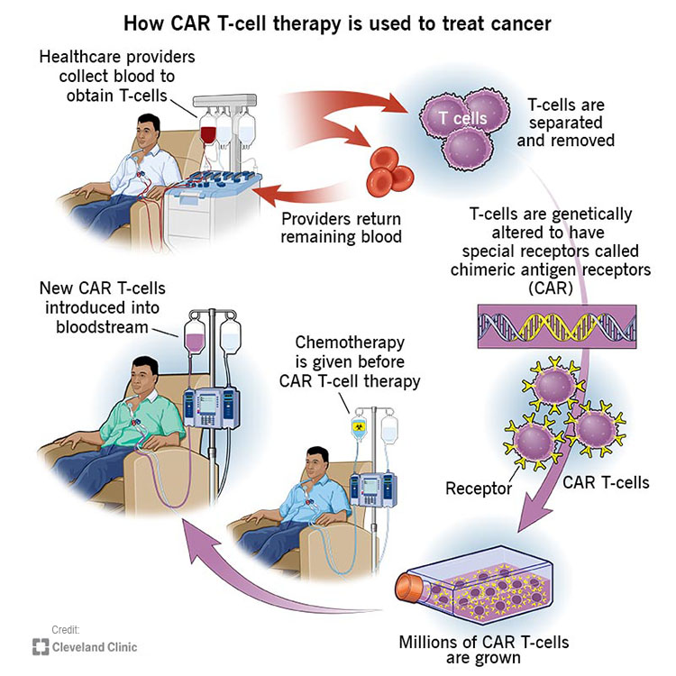 what-is-car-t-immunotherapy.jpg